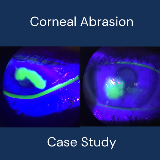 How to treat corneal abrasion/scratch